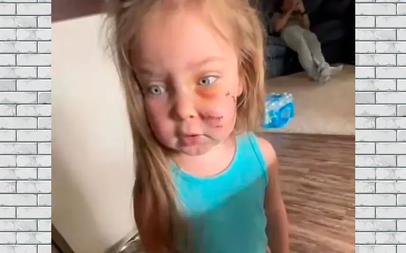 Mulher é criticada por manter cachorro que mordeu a filha Mulher-e-criticada-por-manter-cachorro-que-mordeu-a-filha