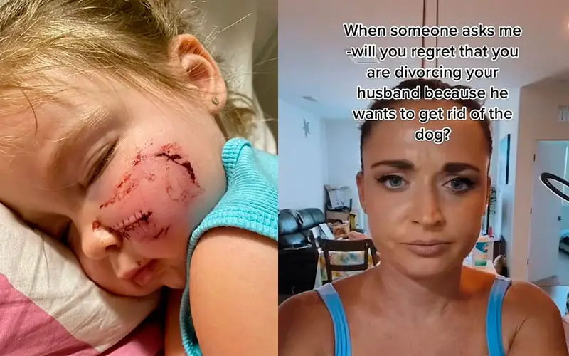 Mulher é criticada por manter cachorro que mordeu a filha Mulher-e-criticada-por-manter-cachorro-que-mordeu-a-filha