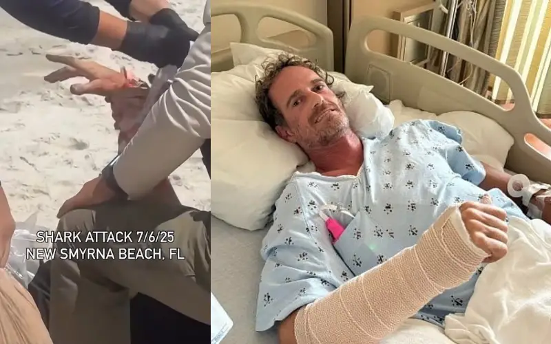 Surfista é atacado por tubarão na “capital mundial das mordidas” e sobrevive por pouco: “Parecia eletricidade” Surfista é atacado por tubarão na “capital mundial das mordidas” e sobrevive por pouco: “Parecia eletricidade”