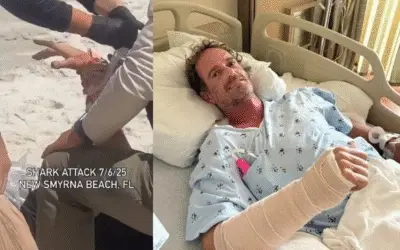 Surfista é atacado por tubarão na “capital mundial das mordidas” e sobrevive por pouco: “Parecia eletricidade”